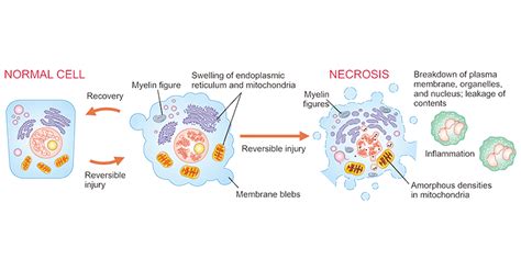 Get an Overview of Necrosis Research- CUSABIO