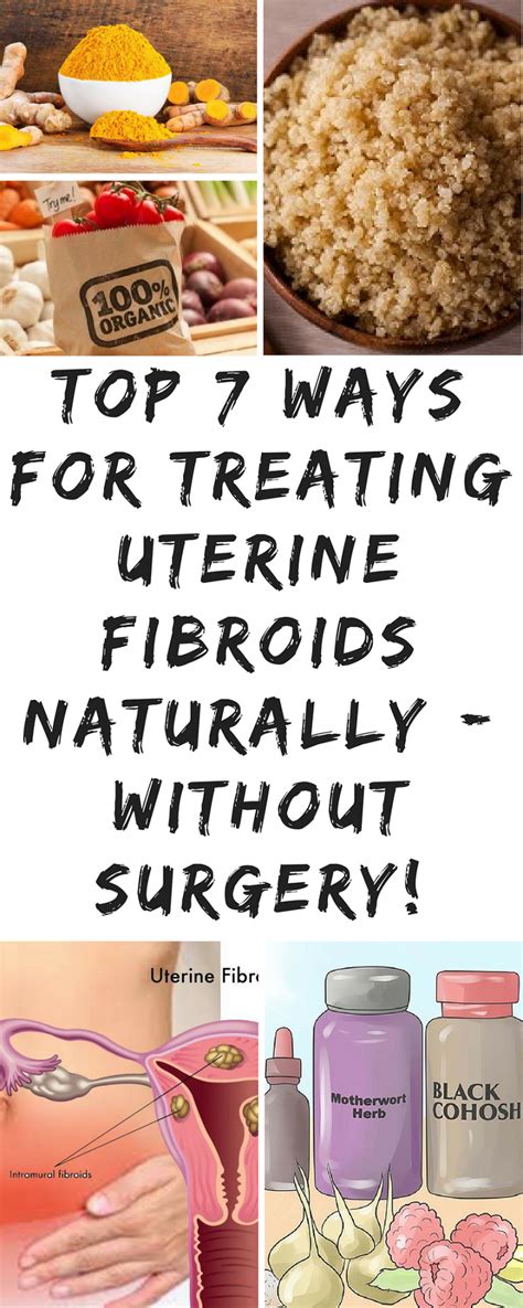 Top 7 Ways for Treating Fibroids Naturally – Without Surgery (With images) | Fibroids, Ovarian ...