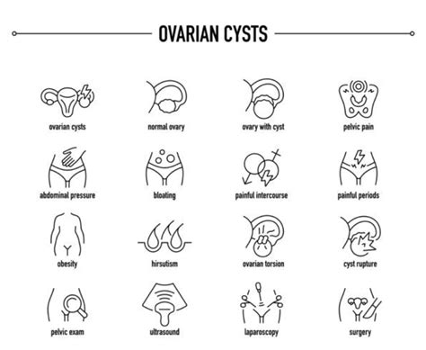 Ovarian Cysts and Infertility