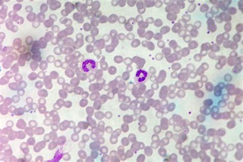 Plasmodium vivax 400x zoomed in | Nancy | Flickr