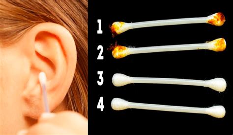 Your Earwax Can Indicate Your Health And Conditions: What Color Is ...