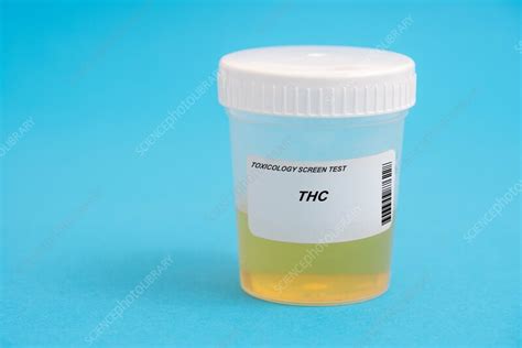 Urine test for THC - Stock Image - F036/9580 - Science Photo Library