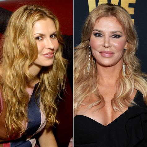 Real Housewives' Plastic Surgery: Before and After Photos