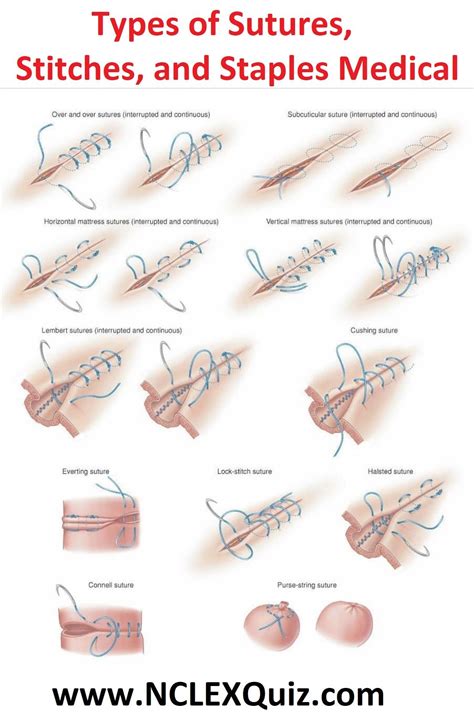 Home - Success Learned | Medical school essentials, Surgical suture ...