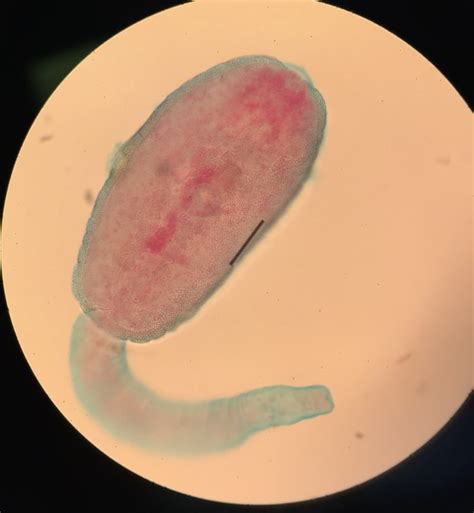 The Cercaria of Fasciola hepatica, a liver fluke found in humans : microbiology