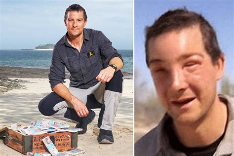 Bear Grylls knocked out by bee sting during life threatening allergic ...