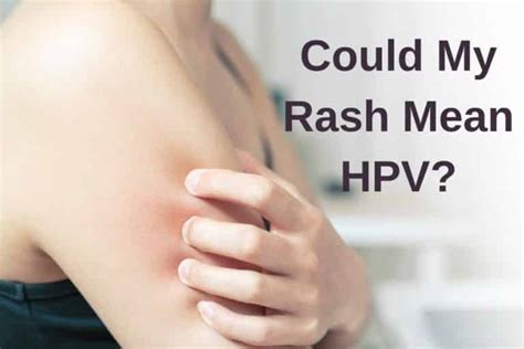 Could your rash be a symptom of HPV? - Papillex®