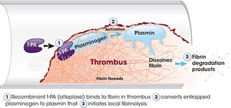 Alteplase Mechanism of Action - PorterbilCastillo