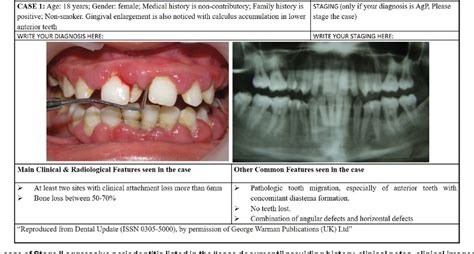 Figure 4 from Differential Diagnosis between Chronic versus Aggressive Periodontitis and Staging ...