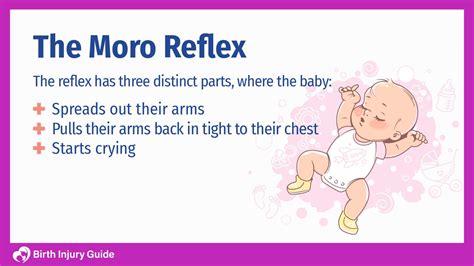 Are Birth Asphyxia and Moro Reflex Related? - Birth Injury Guide