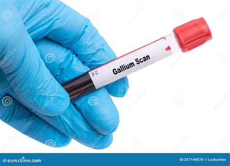 Gallium Scan Medical Check Up Test Tube with Biological Sample Stock ...