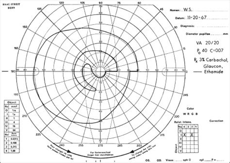 Visual field interpretation | Ento Key