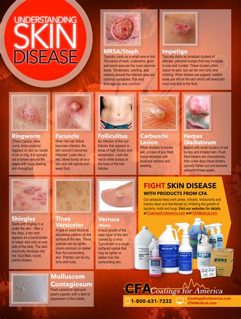 CFA Medical :: Understanding Skin Disease 18'' x 24'' Heavy Poster