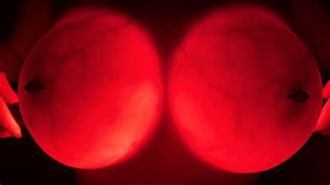 bright lights, big implants : r/glowtits