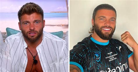 Love Island star Jake Cornish reveals secret hair transplant results