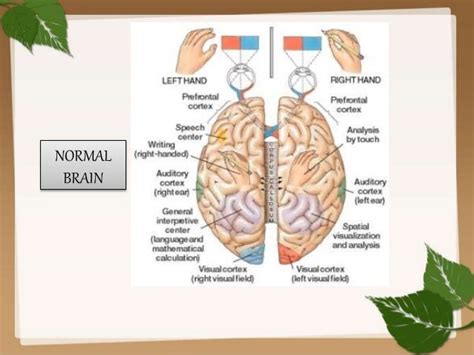 Brain lateralization