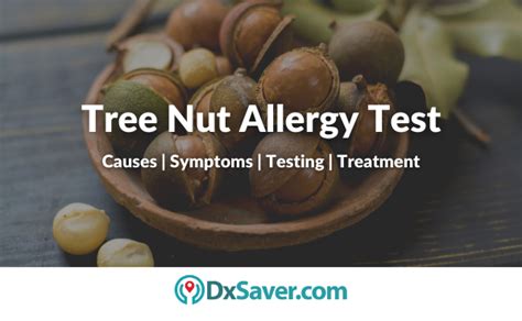 Nut Allergy: Causes, Symptoms, Risk Factor, Testing and Treatment ...