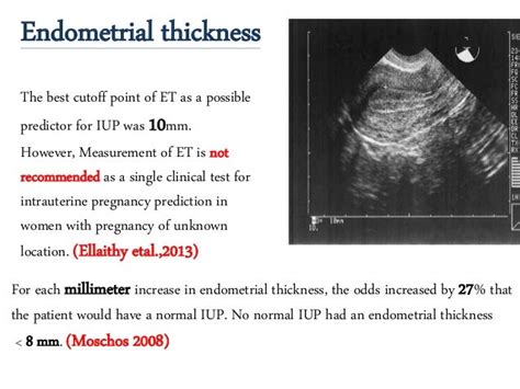 Pregnancy of unknown location