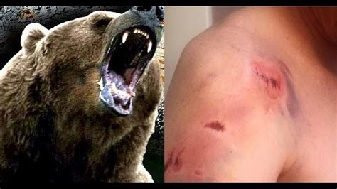 Montana man posts graphic video showing aftermath of grizzly bear attack | wqad.com