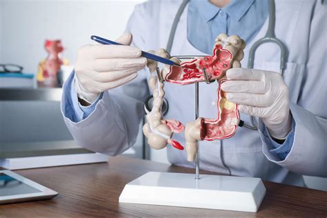 What to Consider When Selecting a Gastroenterologist - Birmingham ...