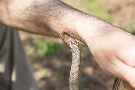 Snake Bite Pictures, Images and Stock Photos - iStock