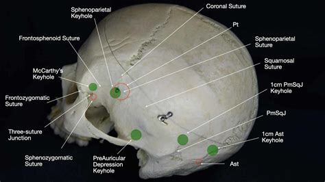 12+ platinum orbital diagram - RoanAdela