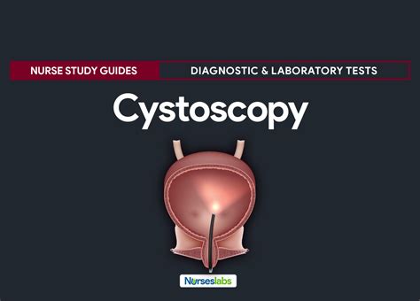 Cystoscopy - Nursing Responsibilities - Nurseslabs