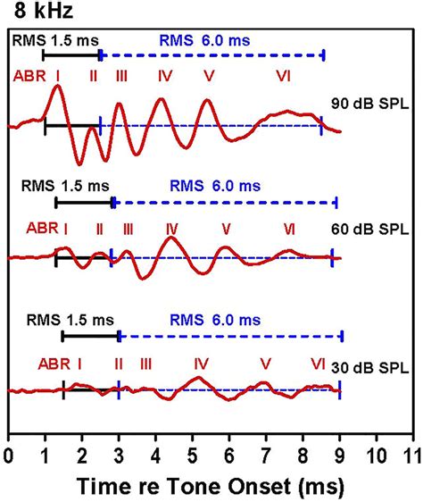 Examples of auditory brainstem response (ABR) waveforms elicited by 8... | Download Scientific ...