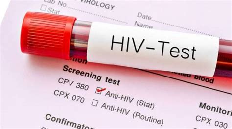 Advertising Post viral load tests, number of people with HIV taking ...