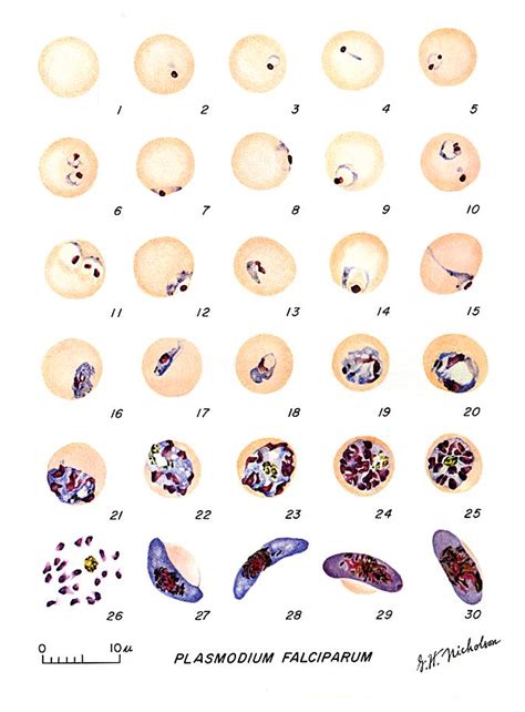 Plasmodium Vivax Thick Smear