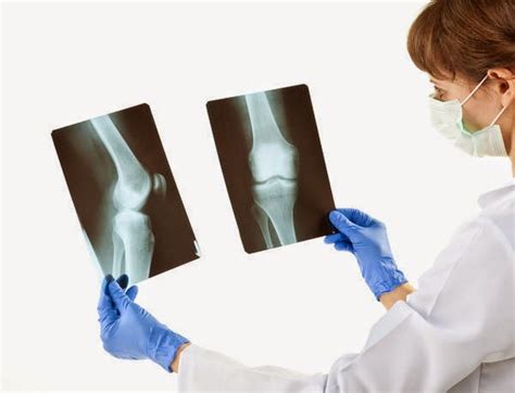 Medical Treatment Pictures-for Better Understanding: Arthroscopic Knee Synovectomy Surgery ...