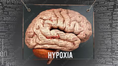 Hypoxia anatomy - its causes and effects projected on a human brain ...