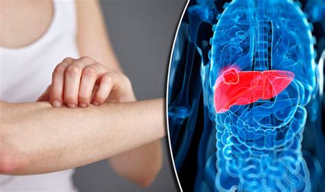 11 Signs That Your Body Sends You To Tell You That Your Liver Is Sick