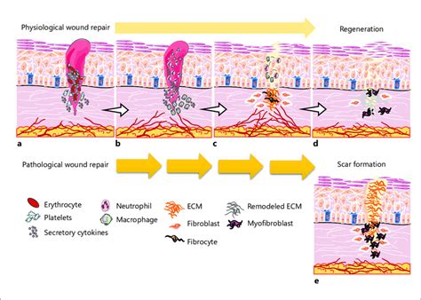 The cutaneous wound healing process, a regenerative or reparative... | Download Scientific Diagram