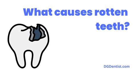 Rotten Teeth: Causes, Symptoms & Treatment - DG Dentist