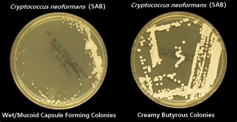 Fun With Microbiology (What's Buggin' You?): Cryptococcus neoformans