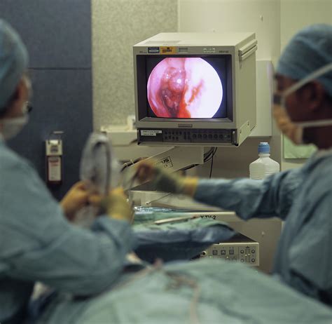 Nasal Polyp Surgery Photograph by Mark Thomas/science Photo Library ...