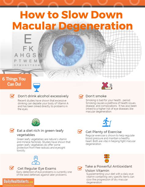 How To Slow Down Macular Degeneration | Daily Health Alerts
