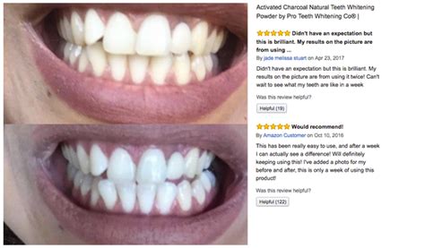 Activated Charcoal for Teeth Whitening – Pro Teeth Whitening Co