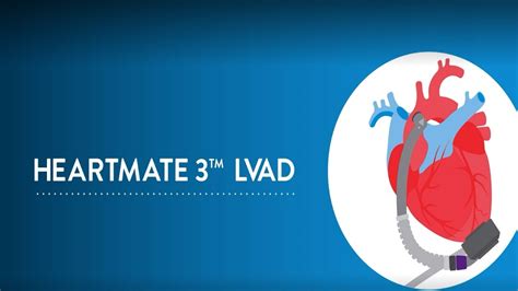 How the HeartMate 3 Left Ventricular Assist Device (LVAD) System Works ...