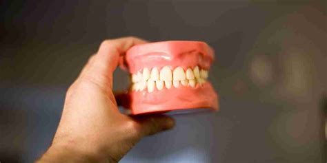 Affordable Dentures: Pros and Cons - San Diego Implant Clinic