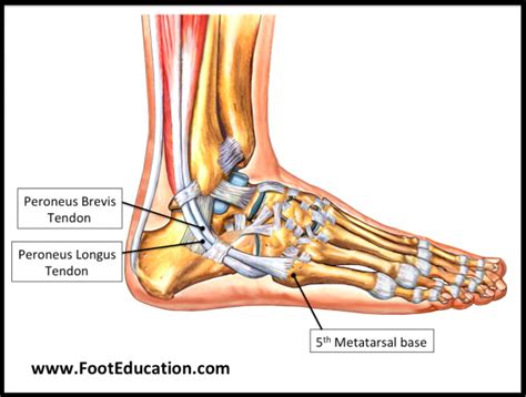 Flexor Hallucis Longus Tendon Transfer to the Peroneus Brevis - FootEducation