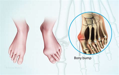 Health Condition : Symptoms, Causes, Treatment and More