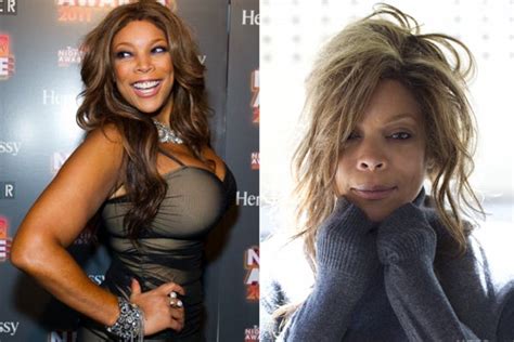 Wendy Williams Plastic Surgery - TV Host Quotes On Race & Beauty