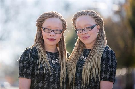 Nigerian Albino Twins Take Over Fashion World In US | FabWoman