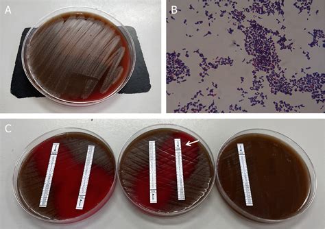 Blood culture results. (A) Growth of colonies of Abiotrophia defectiva... | Download Scientific ...