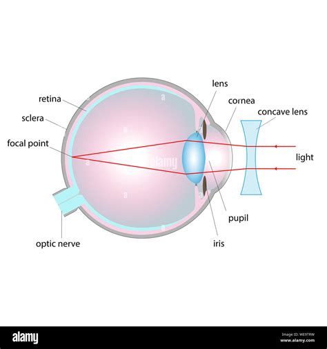 Concave Lens Definition, Uses Examples Video Lesson, 56% OFF