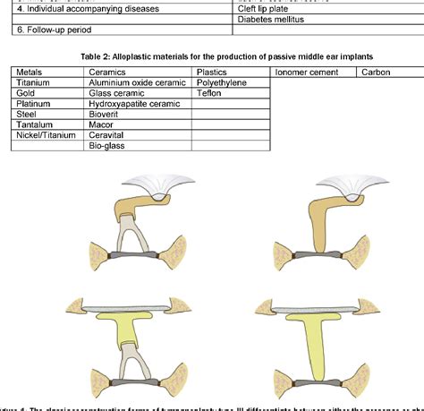 Implant, Middle Ear | Semantic Scholar