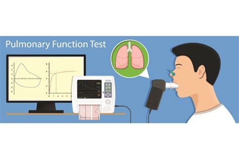 Lung Function Test in Singapore - Interventional Pulmonology Clinic