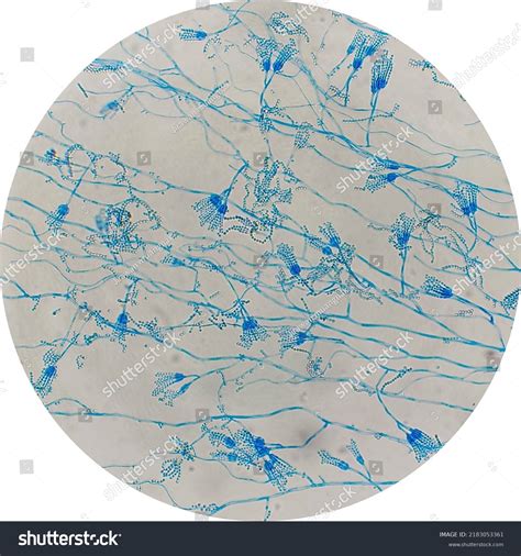 Penicillium Under Microscope 400x